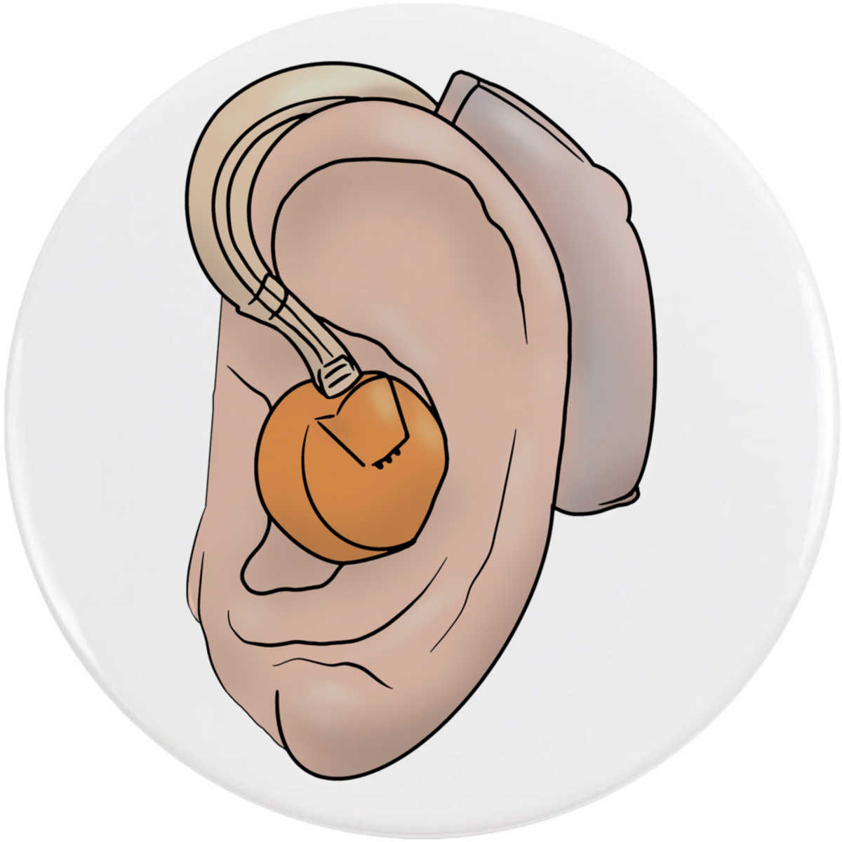 77mm 'Hearing Aid' Large Button Pin Badge (BB00087644)