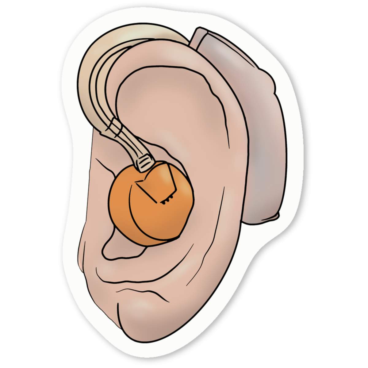 'Hearing Aid' Premium Vinyl Decal Stickers – Waterproof, Durable & Easy to Apply - Ideal for Cars, Windows, Bins and More (DW034718)