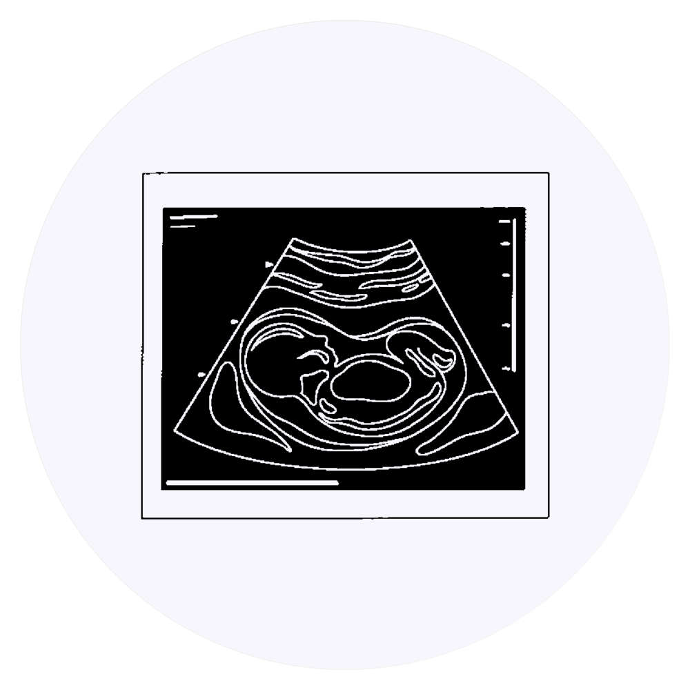 24 x 'Ultrasound Baby Photo' Stickers - for Crafts, Scrapbooking and Labelling (SK00071388)