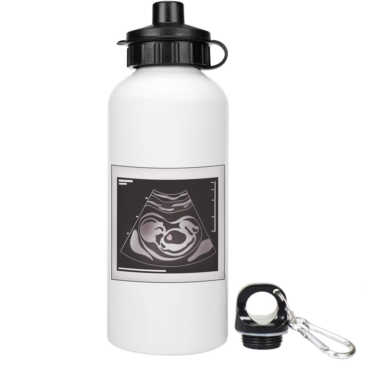 'Ultrasound Baby Photo' Reusable Water Bottles (WT053115)